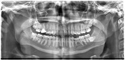 a dental X-ray