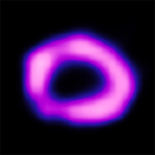 SN1987 X-ray image