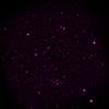 X-ray image